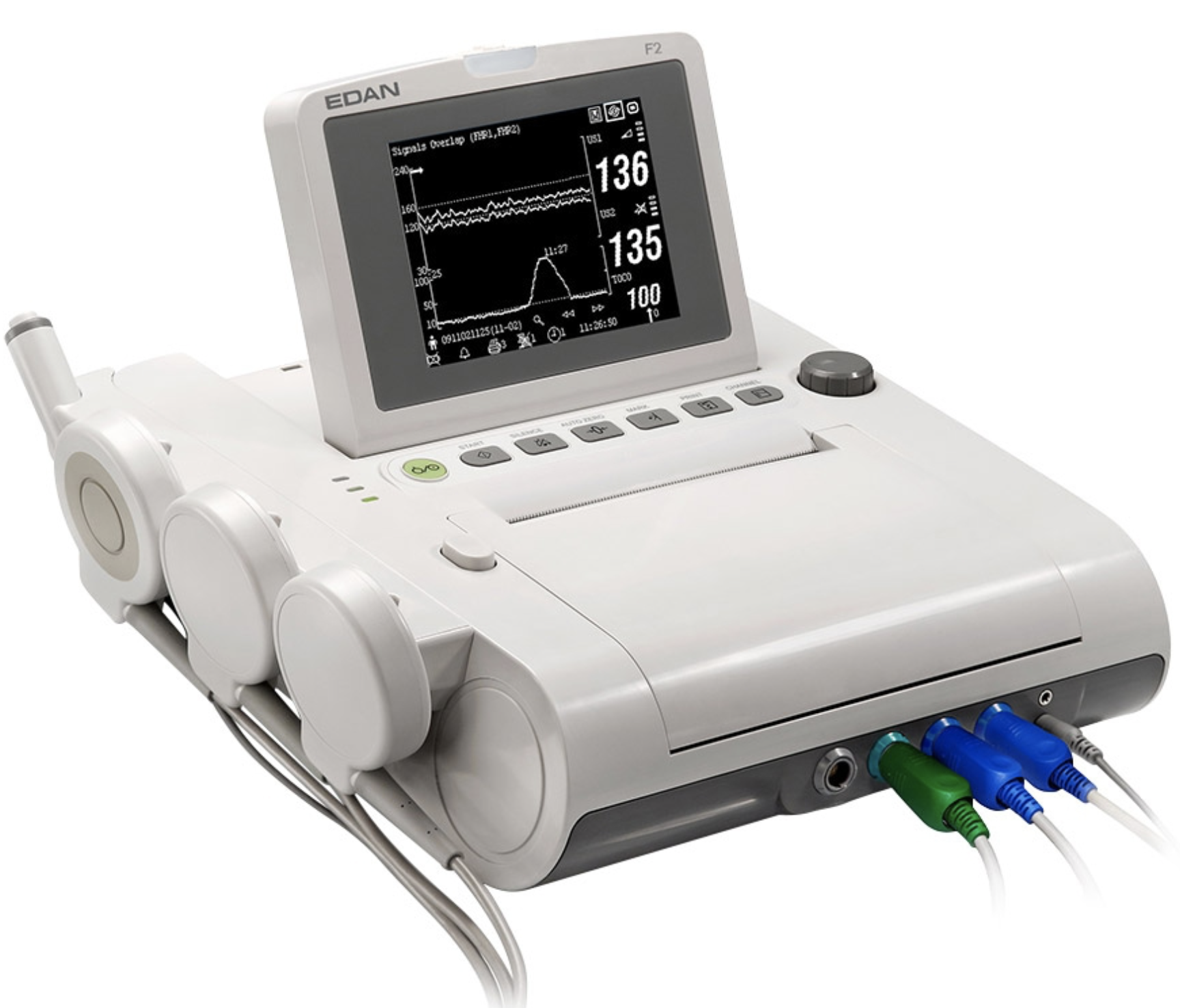 Moniteur foetal - cardiotocographe gémellaire EDAN F2